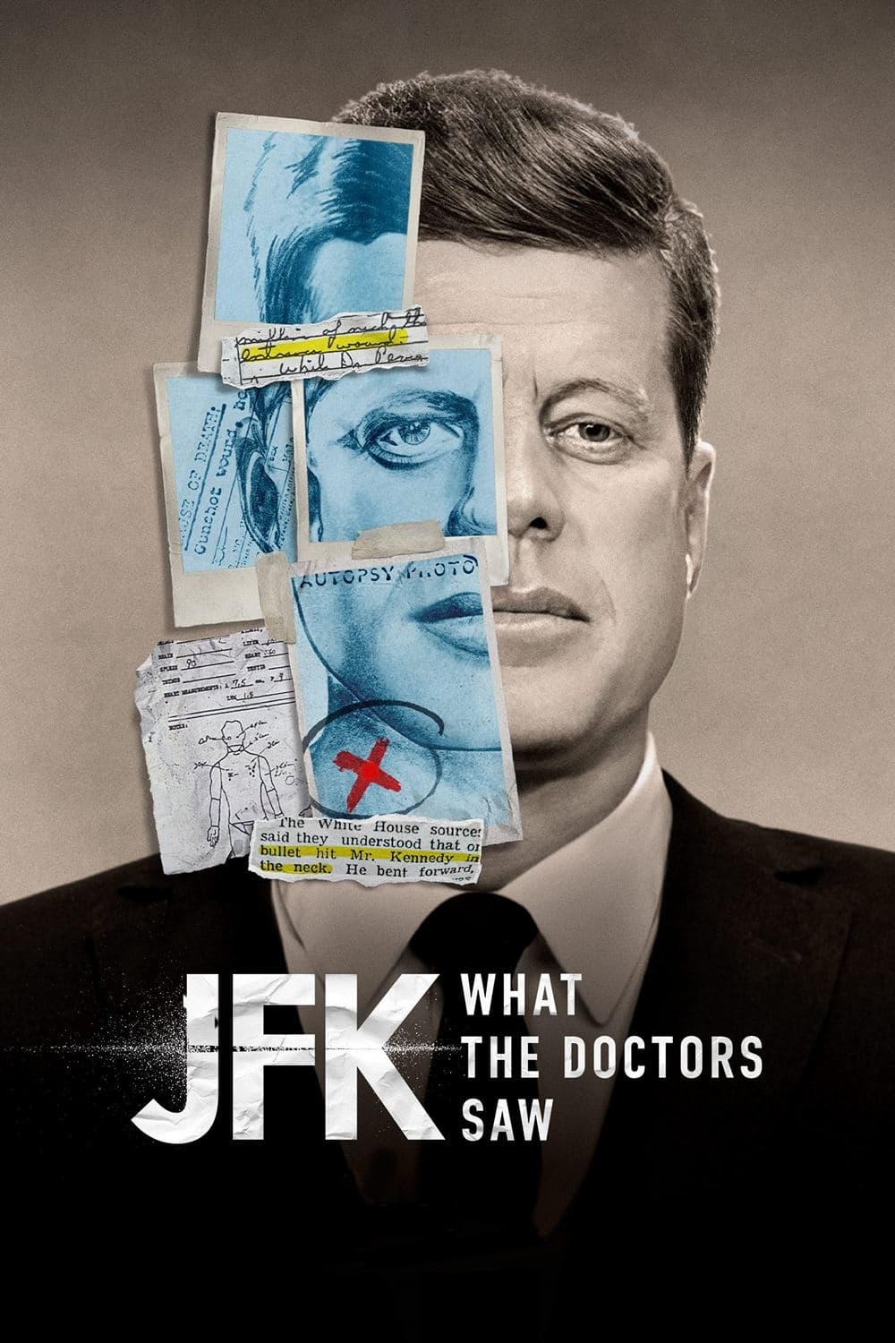 JFK: آنچه پزشکان دیدند